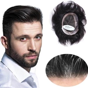 پروتز مو برای آقایان با ظاهر جذاب و شیک