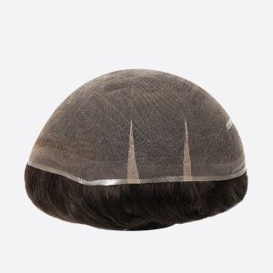 پروتز مو برای پوشش طاسی