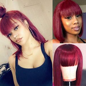 نصب پروتز مو