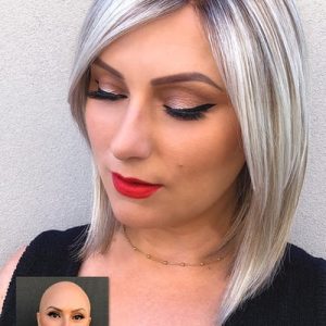 پروتز مو برای خانم‌ها