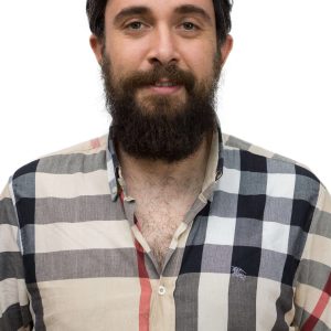 پروتز مو زنانه با نصب راحت و بدون نیاز به کمک