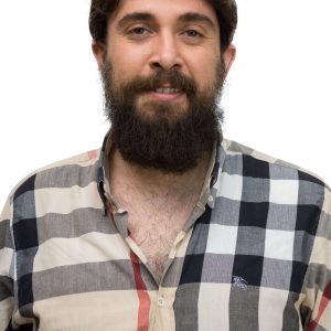 پروتز مو مردانه با چسبندگی قوی و دوام بالا