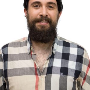 پروتز مو مردانه با طراحی استاندارد برای استفاده طولانی