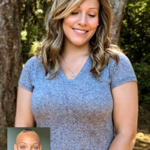 پروتز مو برای استفاده طولانی مدت