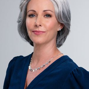 پروتز مو با نصب آسان