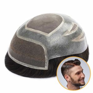 پروتز مو حرفه ای مردانه