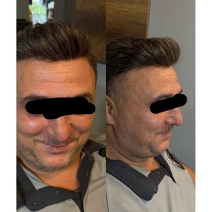 چسب پروتز مو واکرتیپ مدل M04 ۳۰ عددی