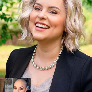 پروتز مو زنانه شیک