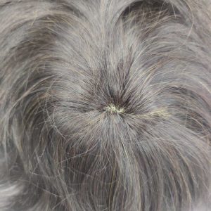 پروتز مو سیلیکونی برای جلو تور طبیعی