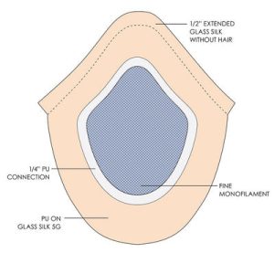 پروتز مو برای افرادی که به زیبایی اهمیت می‌دهند