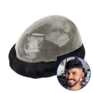 پروتز مو با کیفیت تضمینی و خط رویش طبیعی