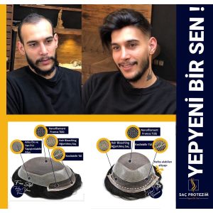 پروتز مو شقیقه جلوسری مردانه مشکی طبیعی