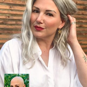 پروتز مو زنانه با ابعاد سفارشی