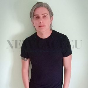 ریمور پوست برای پروتز مو