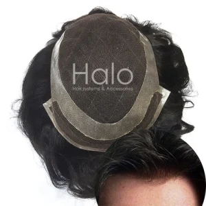 کلاه گیس کره ای