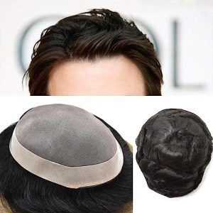 قیمت پروتز مو مردانه کره ای