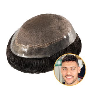 پروتز مو با طراحی دقیق و ماندگاری بالا