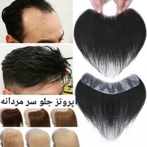 پروتز مو جلوسر مردانه وارداتی کد 2