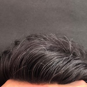 پروتز مو جلوتور آنکارایی بلیچ اورجینال 18×24 رنگ ۱۰ درصد سفیدی | کد: ZNB-VD5