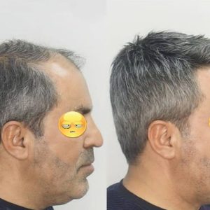 پروتز مو طبیعی هالیودی ۱۰% تا ۸۰% سفیدی | کد: ZNB-VSP