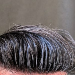 پروتز مو دورسیلیکون نیوزلندی اورجینال 20×25 رنگ 30 درصد سفیدی | کد: ZNB-VF7