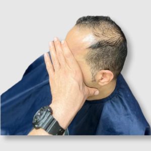 پروتزمو هالیوودی | کد: ZNB-UZQ